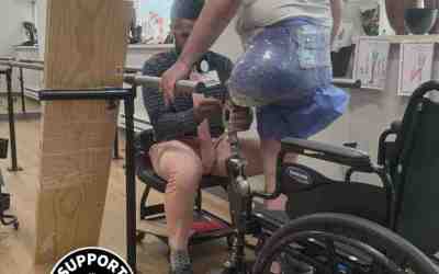 Life After a Motorcycle Accident: Support, Recovery, and Community for Amputee Riders