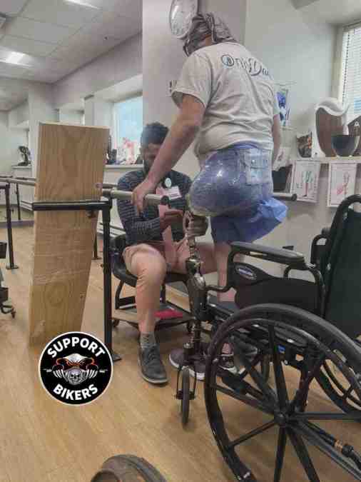 Life After a Motorcycle Accident: Support, Recovery, and Community for Amputee Riders